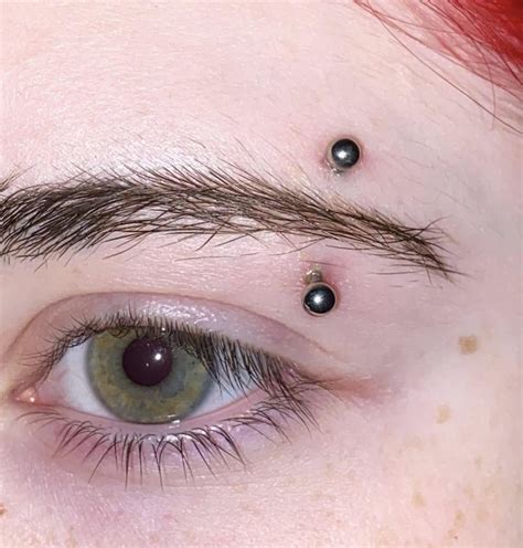 Infected vs irritated piercing